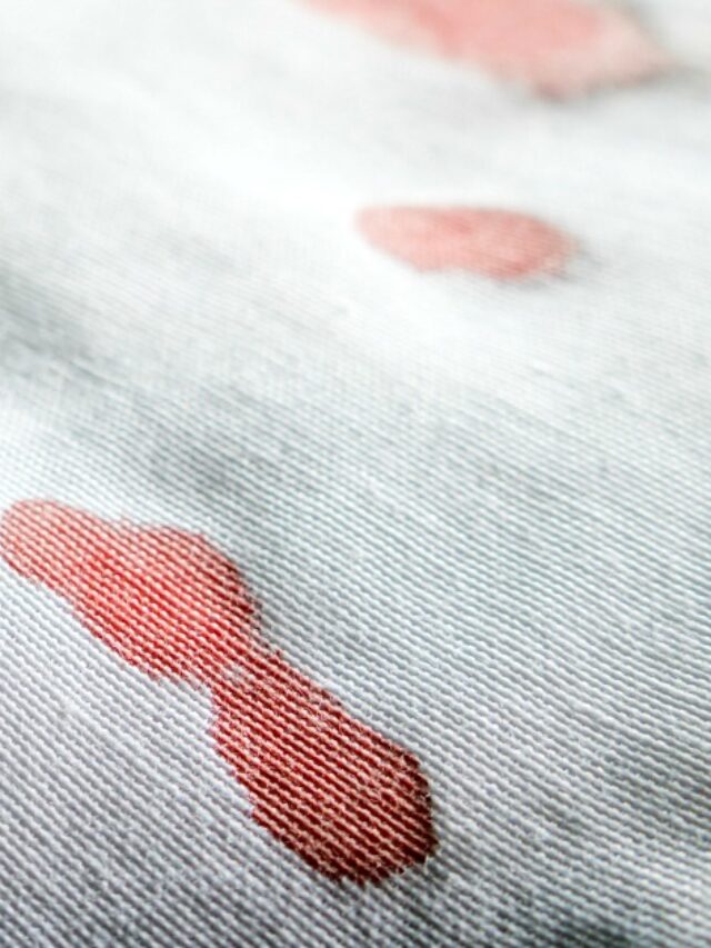 How to Remove Dried Set In Blood Stains from Clothes Story