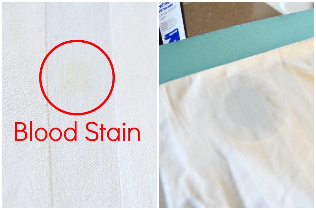 How To Remove Dried Set In Blood Stains From Clothes